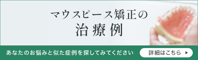 マウスピース矯正の治療例