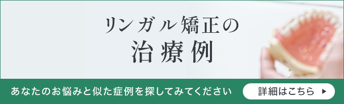 リンガル矯正の治療例