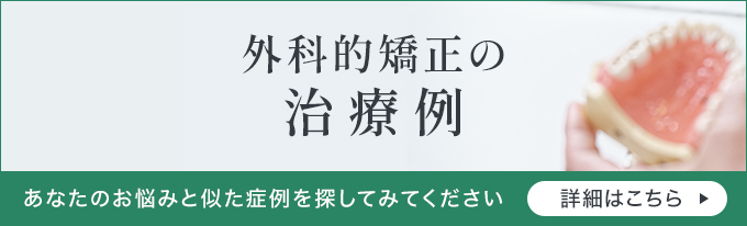 外科的矯正の治療例