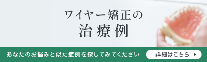 ワイヤー矯正の治療例